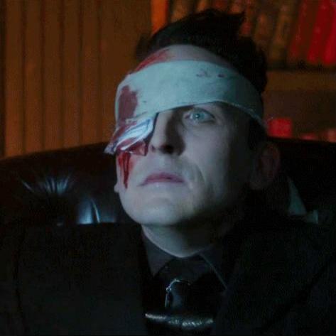 RiddlebirdWeek's tweet photo. Day 14 of #RiddlebirdAdvent and more injuries with Oswald from #Gotham https://t.co/BcxPnOoGOy