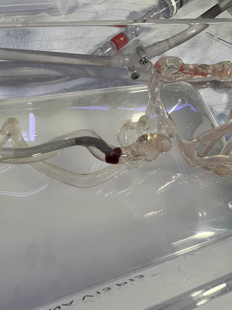 MPeyT1's tweet photo. Hands-on thrombectomy Workshop in Basel #mentice #cerenovus #stroke #basel #neuroRAD #thrombectomy #StrokeCenterBasel @UniSpitalBasel @DKFBasel @UniBasel_en @Mentice @CERENOVUS_HQ https://t.co/6NwUpzVhBU