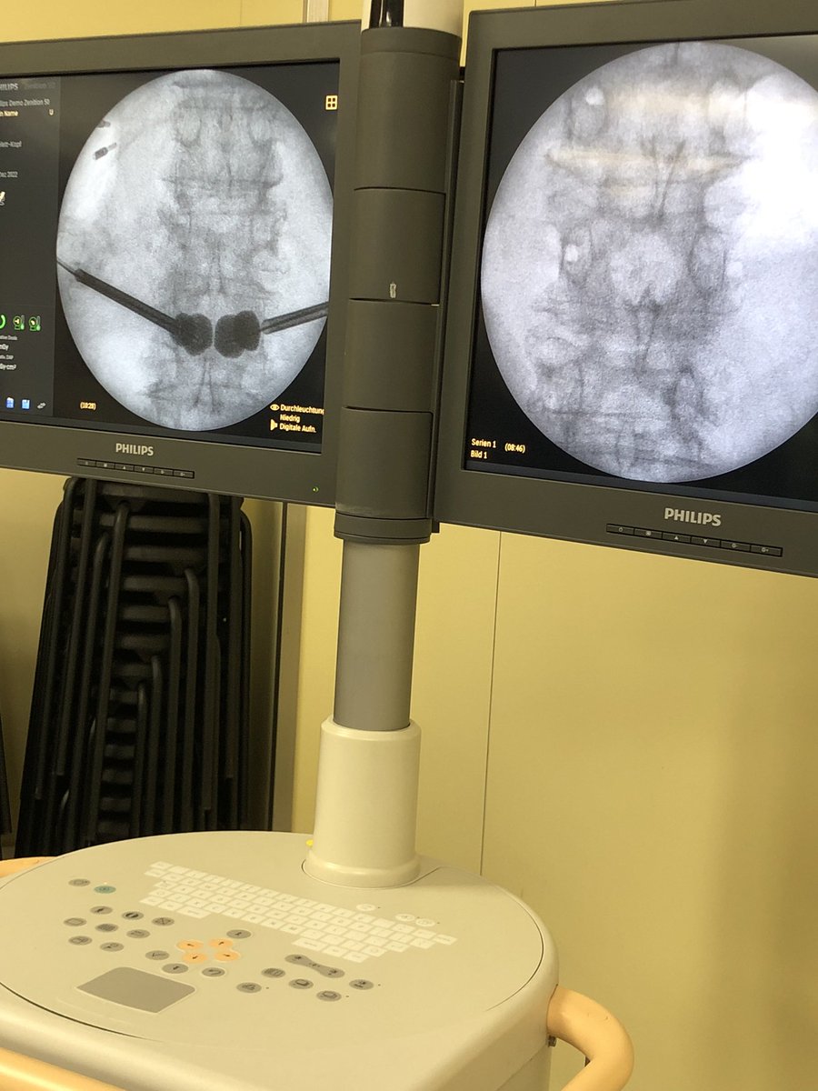 barkanimelilla's tweet photo. Muy interesante e intenso el curso con abordajes transpedicular y extrapedicular a la columna dorsal y lumbar. Seguimos trabajando https://t.co/B67bTv69za