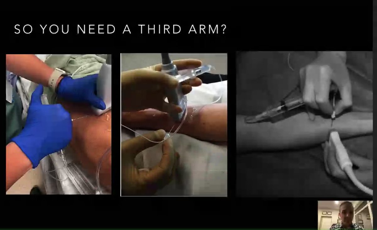 Do you need that third arm during a block? Try these, for injecting your own local anesthetic during a nerve block (especially #1) @tjelic23 @CAEP_EUC @ACEP_EUS