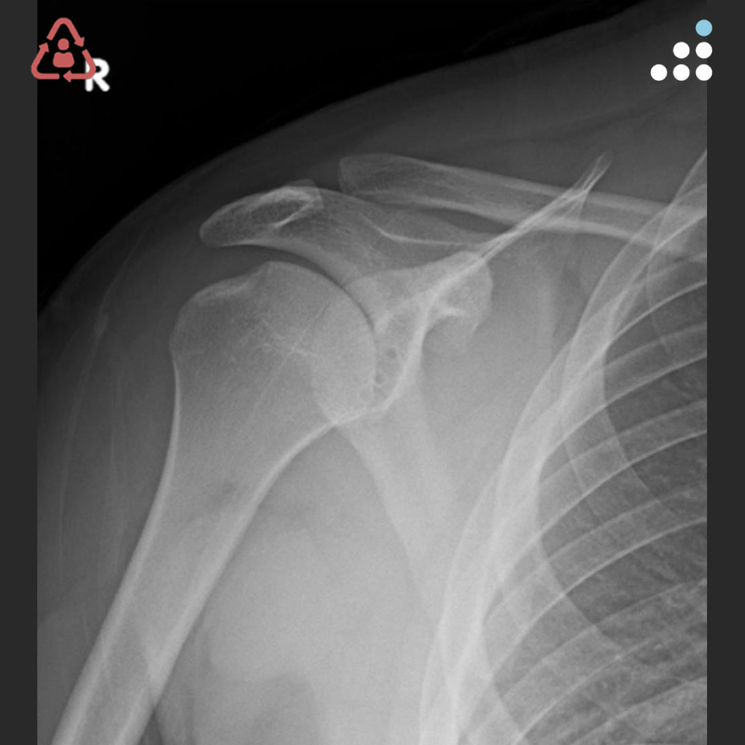 Orthobullets tweet media