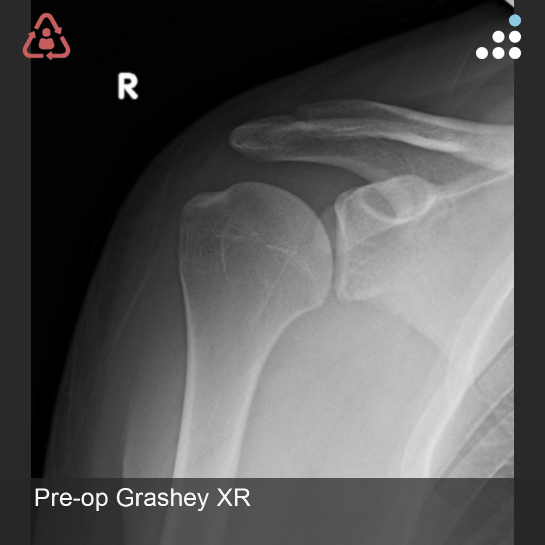 Orthobullets tweet media