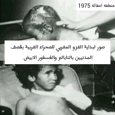 انها صور حقيقية لاطفال الصحراء الغربية
ولازال الشعب الصحراوي الى اليوم في معاناة مع الجار المغرب....الله يهدي من يشاء
#الحرية للصحراء الغربية
#قروب_احرار_فلسطين