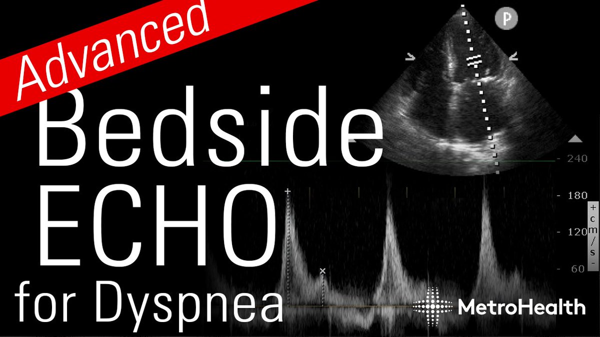 Just posted: Bedside ECHO to evaluate patients with dyspnea from last week's Ultrasound Grand Rounds.  This was a great conversation with @mtabbut and Dr. Ziad Shaman.

youtu.be/L3KDozb5wt0

#MetroEUS #POCUS #echofirst #Ultrasound