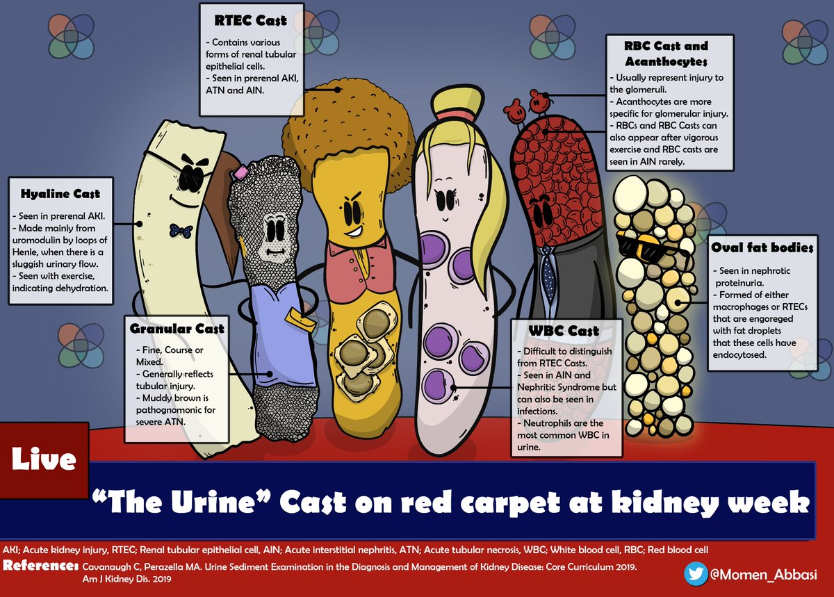 RenalFellowNtwk's tweet photo. Kidney Comics: The "Urine" Casts #KidneyComics @momen_abbasi https://t.co/CJFOsktGo9 https://t.co/7a2eQycjl1