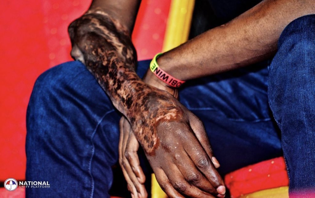 woundedUgandan's tweet image. SANCTION DICTATOR museveni #BringBackOurPeople