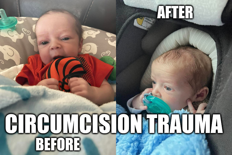 TheGuardianAn15's tweet photo. This morning: #CIRCUMCISION #TRAUMA
#BabyCutter father boasts, "Lil man got #circumcised today. Poor guy. Deep in thought."
Public commentary turned off, friends are no help to the #CHILD.
OP: https://t.co/0umkE0Uqsr
Profile: https://t.co/3otyxSOeuB
News, etc., in image descript https://t.co/eeyGKwxl4f
