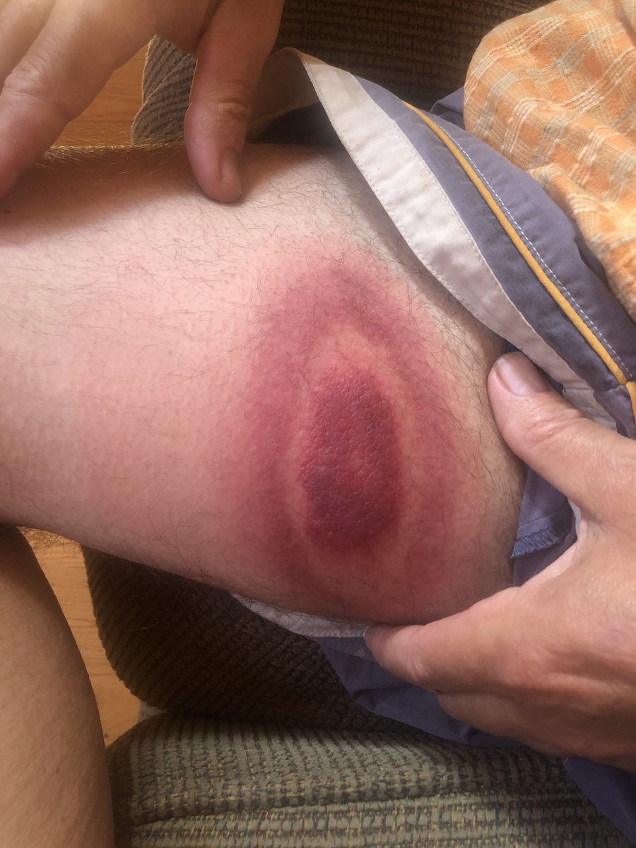 Sam Atallah, MD tweet media