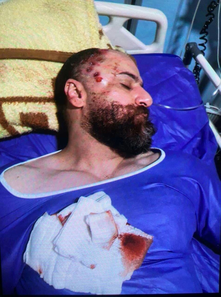 AlinejadMasih's tweet photo. The name of this honourable angel is Mehdi Aulee. During protests in the city of #Arak, he endangered his own life to save a female protester from the regime’s clutches. After saving her, he was shot. He’s in serious condition in hospital.
#IranRevolution https://t.co/no2cdR7TZ3