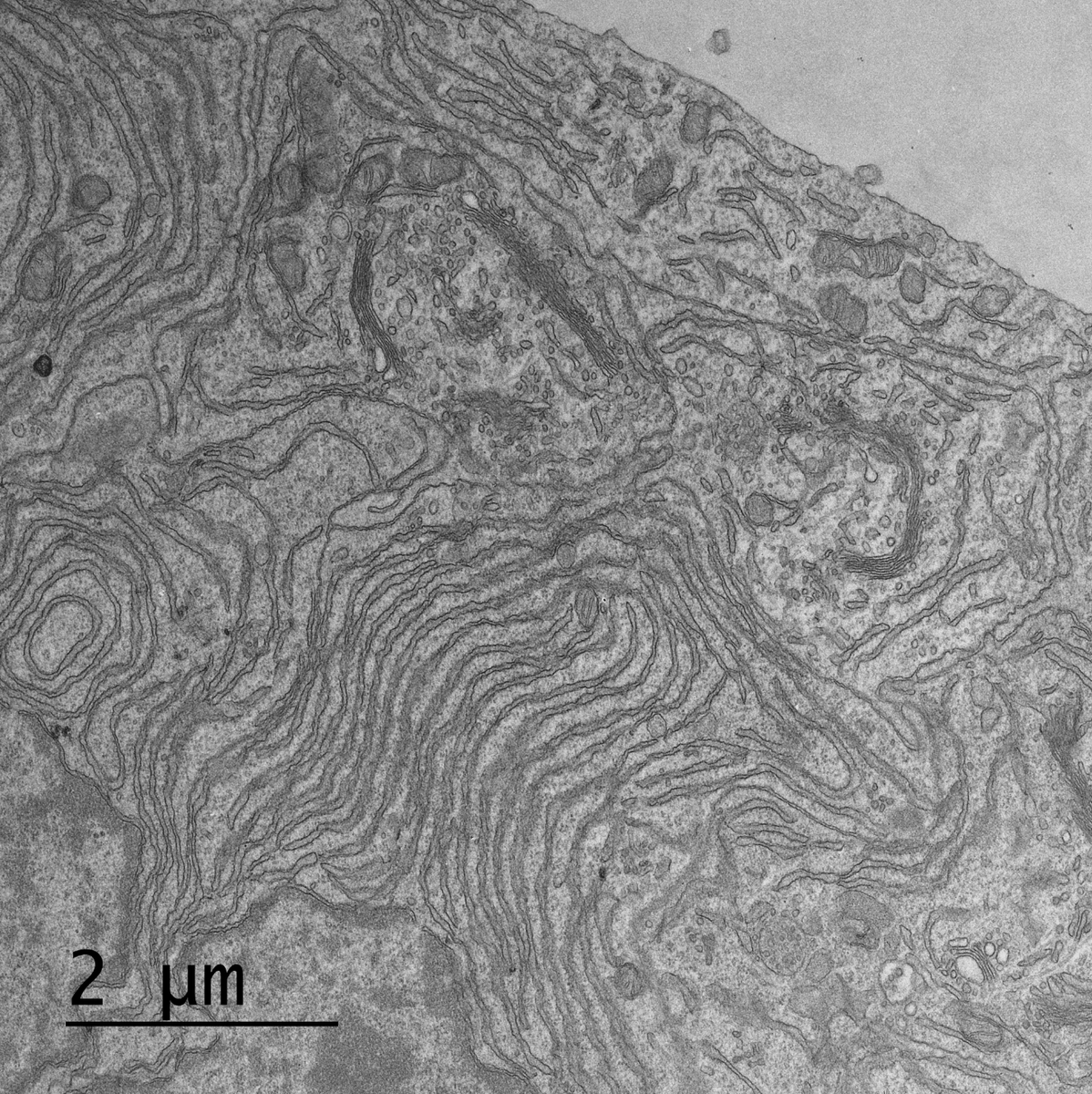 LeoAndrade1974's tweet photo. There's been an increasing interest in studying the interaction between mitochondria - ER and its physiological relevance. Regulation of Ca2+ homeostasis, phospholipid metabolism, mitochondrial morphology / dynamics and autophagosome formation are few examples. https://t.co/IM2OuO2W4N