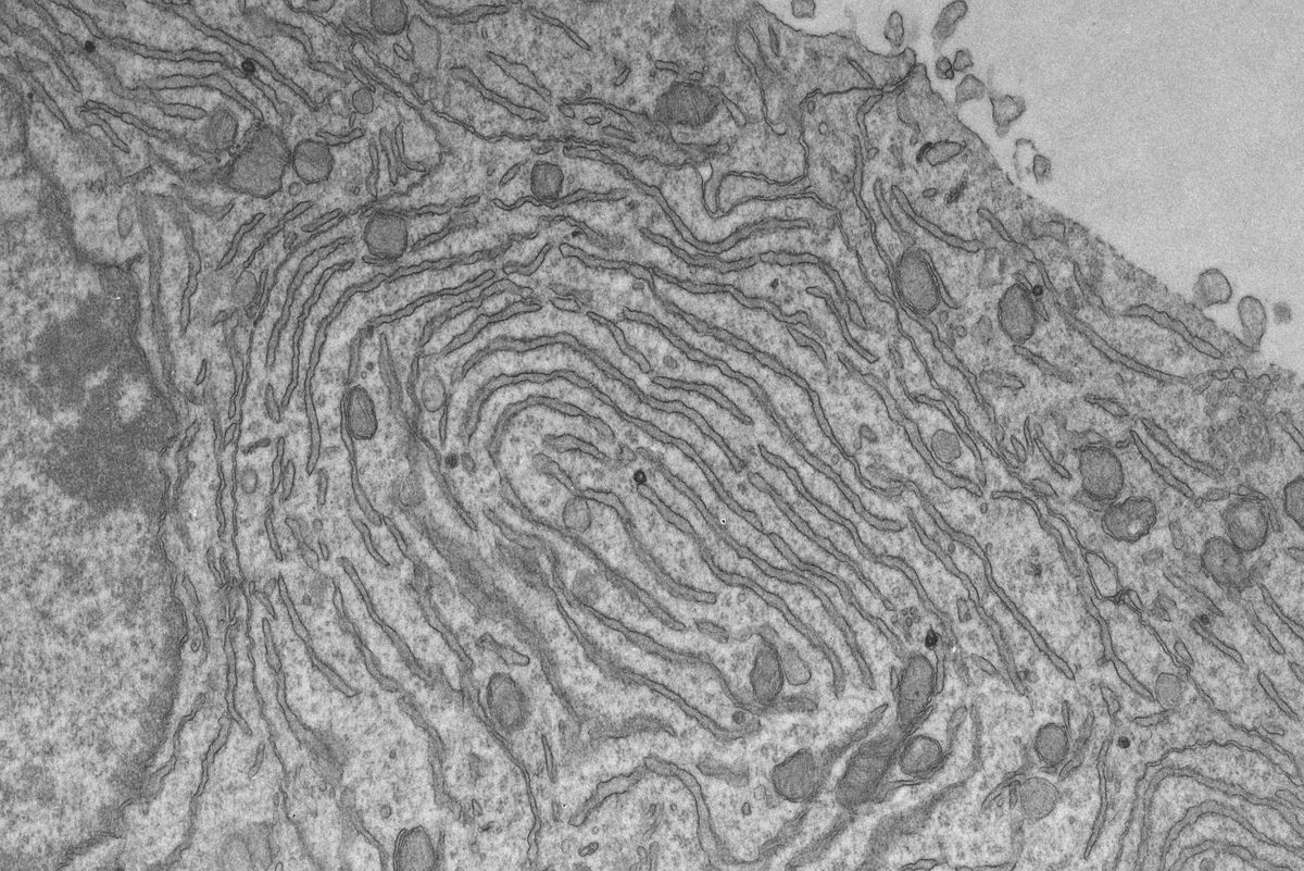LeoAndrade1974's tweet photo. There's been an increasing interest in studying the interaction between mitochondria - ER and its physiological relevance. Regulation of Ca2+ homeostasis, phospholipid metabolism, mitochondrial morphology / dynamics and autophagosome formation are few examples. https://t.co/IM2OuO2W4N