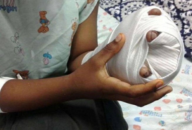 FranciaGuardio1's tweet photo. La Dirección de Niñez, Adolescencia y Familia (DINAF) dio a conocer que los niños quemados por pólvora esta navidad serán separados de sus padres y que además estos enfrentarían procesos legales por permitirles la manipulación de pólvora.

#Polvora #Navidad #DINAF #NiñosQuemados https://t.co/TdmHnrFGpk