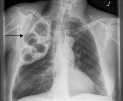 NephroPOCUS tweet media