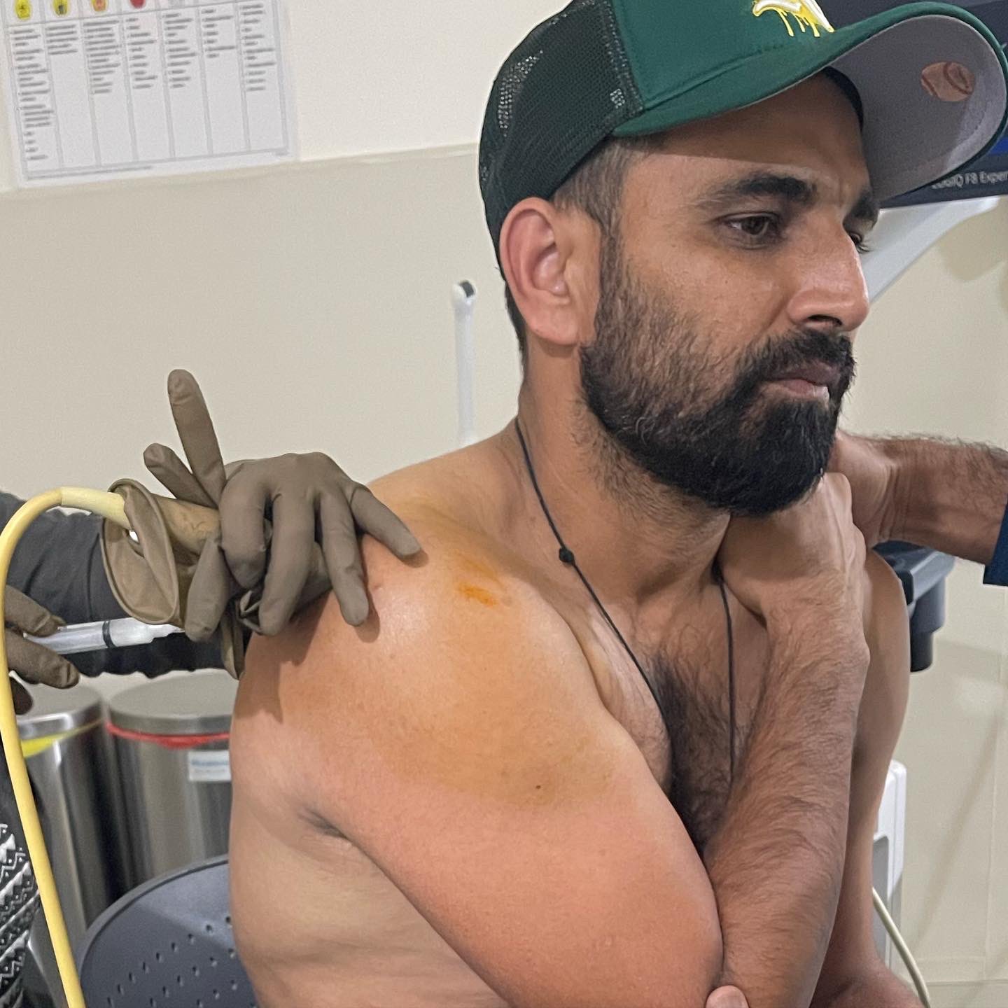 Mohammad Shami Injury, IND vs BAN LIVE, India Bangladesh ODI series, IND BAN ODI Series, India vs Bangladesh LIVE, Umran Malik, Mohammad Shami replacement