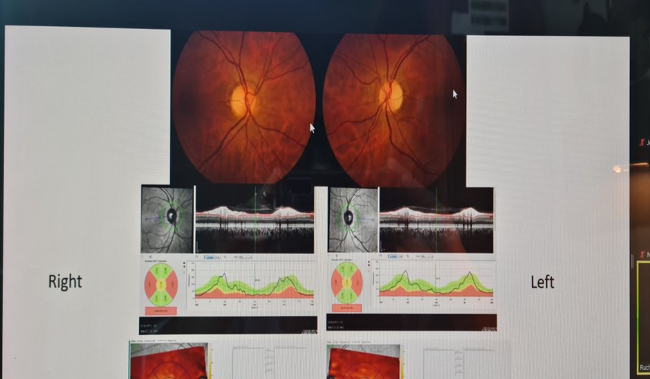 Karavitaki_Niki's tweet photo. 8th Birmingham Pituitary Preceptorship International Meeting #BirminghamPituitaryAcademy Ruchi Batra explaining visual morbidities in patients with pituitary disease! Value of team work! @BHPComms @IMSR_UoB https://t.co/VAnscCFwx1