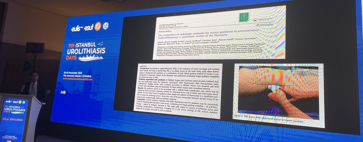 Feyzi Arda ATAR (@ardatar) on Twitter photo Including USG in the access strategy in #PCNL reduces radiation exposure
<a href="/bilaleryildiri1/">bilaleryildirim</a> at #IUD2022
<a href="/ISlithiasisdays/">Istanbul Urolithiasis Days</a> <a href="/drkemalsarica/">Kemal Sarıca</a> <a href="/tzevattefik/">Tzevat TEFIK</a> <a href="/elgrecocan/">Murat Can Kiremit</a> Including USG in the access strategy in #PCNL reduces radiation exposure
<a href="/bilaleryildiri1/">bilaleryildirim</a> at #IUD2022
<a href="/ISlithiasisdays/">Istanbul Urolithiasis Days</a> <a href="/drkemalsarica/">Kemal Sarıca</a> <a href="/tzevattefik/">Tzevat TEFIK</a> <a href="/elgrecocan/">Murat Can Kiremit</a>