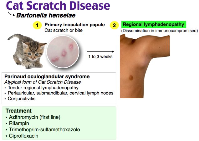 Cat scratch fever shop treatment