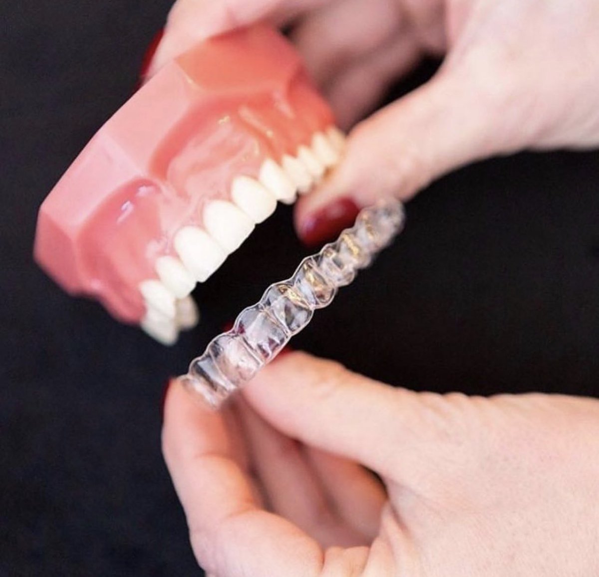 yourdentalloft's tweet photo. Curious about Invisalign? Call us for a consult! We’d love to help you with a treatment plan that helps you reach your smile goals! #dentalloftsmiles https://t.co/bcEtPouRd1