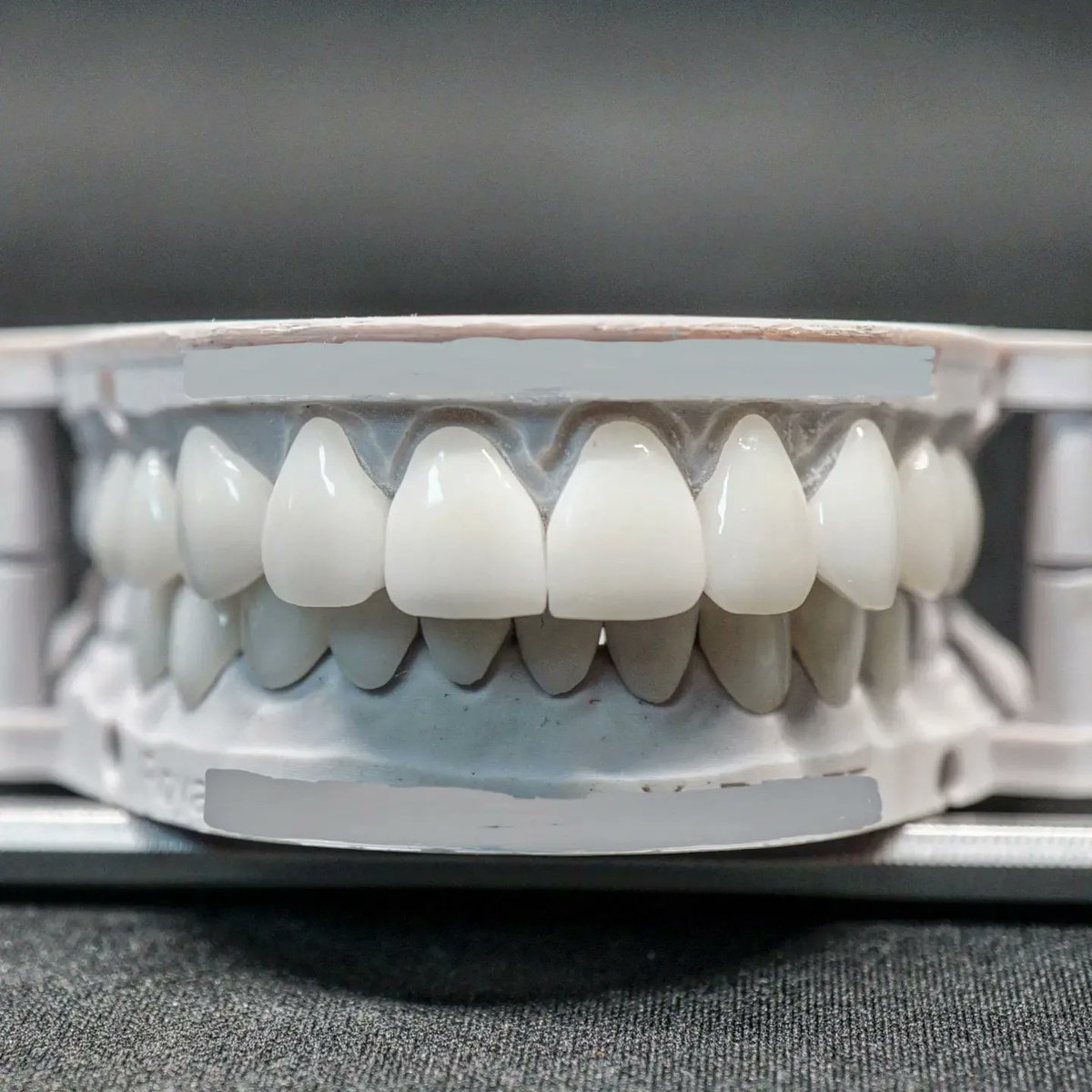 CAD_Robert_3D's tweet photo. I still make teeth! #Zirconia #Veneers designed recently in #exocad 

3D  CAD Preview link: https://t.co/P0cQf1nUIj https://t.co/5E5Ew6mo10