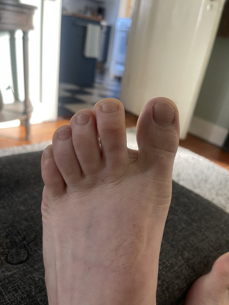 jfeetz15's tweet photo. Do we like a little hair on the feet? 🤫 https://t.co/e666cyf4XT