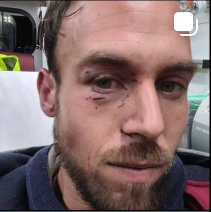 Cuatro agentes de seguridad del Metro de Madrid agreden a un pasajero que se negaba con la exención médica legal a no portar la mascarilla ni bajarse del tren.
El pasajero exigió el nº de identificación y ninguno lo hizo 
Los Agentes han cometido diversos delitos... DENUNCIAR !!