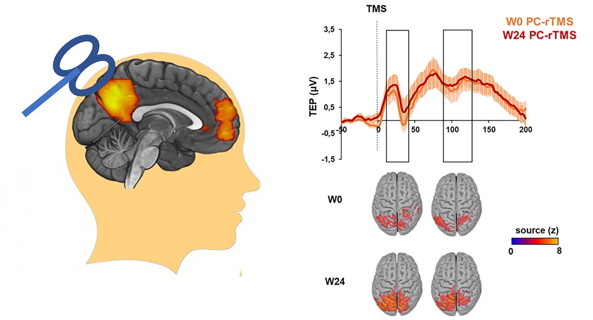 In a randomized, double-blind, phase II trial, Koch et al. find that 24 weeks of repetitive transcranial magnetic stimulation of the precuneus slows down cognitive and functional decline in patients with Alzheimer’s disease. bit.ly/3SUOGnv