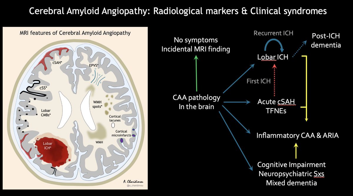 📌Cerebral Amyloid Angiopathy:
🩸🧠MRI markers & Clinical syndromes

#MedTwitter #MedStudentTwitter #neurotwitter #FOAMrad #NeuroRad #Neurology #Neurosurgery  #stroke #dementia #AmyloidAngiopathy #CAA