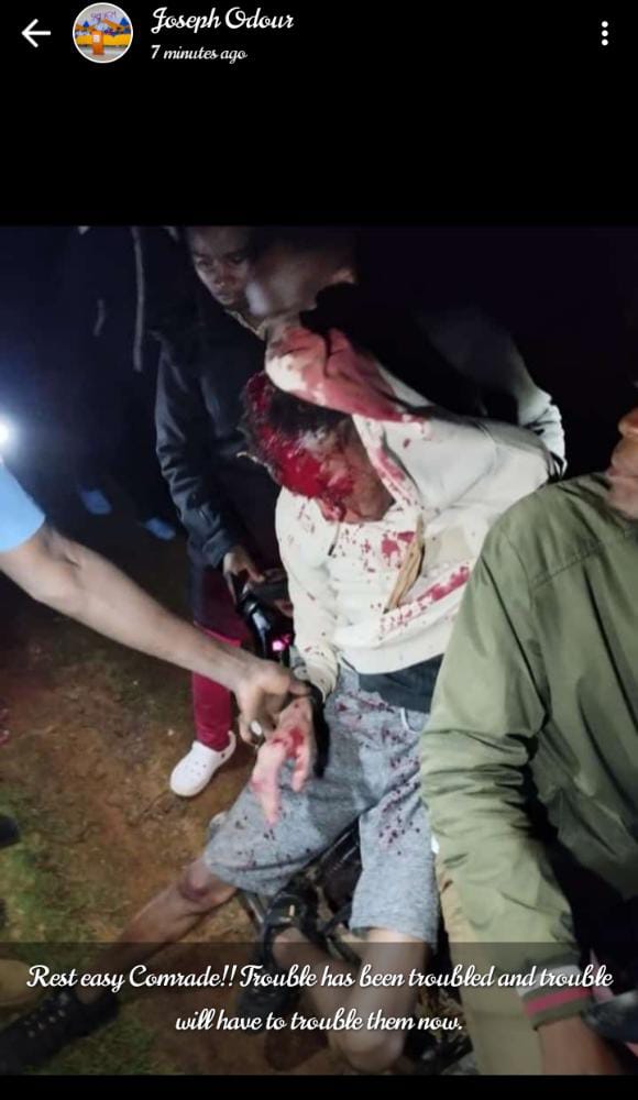 walternyabuto99's tweet photo. @Its_Roddie Go easy comrade
Forever in our hearts you remain 😠
@mksu_official @Machakos_Gov @DCI_Kenya 
We no longer able to withstand this torture https://t.co/E18qLfPpBc
