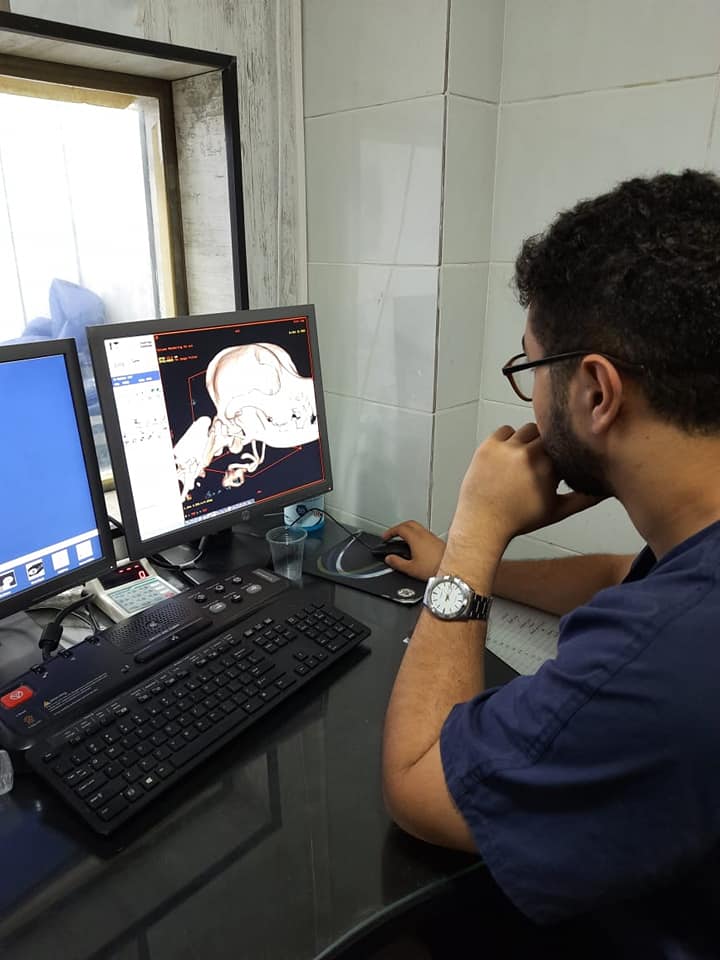 ambarakat0's tweet photo. Results were: 
1- the abnormal shape of the left mandibular condyle (circle)
2- TMJ subluxation (white arrow)
3- retroarticular process hypoplasia 
4- flattened articulating surface
5- ventral subluxation (red arrow)
Finding bilateral
Diagnosis: dysplasia of mandibular condylar https://t.co/h4ZVIhpv6O