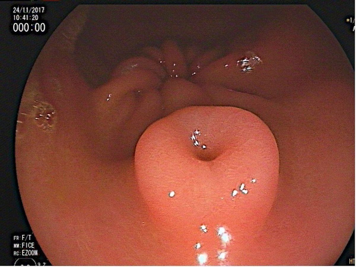 EndoCollab™ | GI Endoscopy Community tweet media