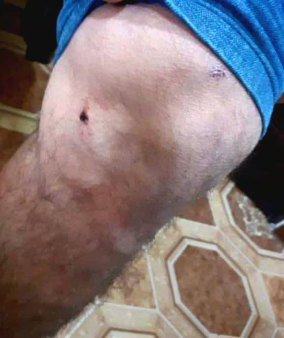araratpetrosian's tweet photo. #AzerbaijanIsATerroristState  attacked young people near the #Getavan  (#Martakert-#Karvachar highway) - details https://t.co/vgJHjLorOB

#Armenia #Azerbaijan #Artsakh #Karabakh https://t.co/BTr5ShpMna
