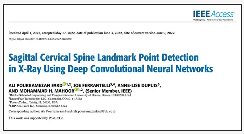 PostureAnalysis's tweet image. So excited for our first paper published in major scientific journal on our Computer Vision module used within our PostureRay Software!  This is true first and &quot;game changer&quot; ...More R&amp;amp;D &amp;amp; published research coming soon!  ieeexplore.ieee.org/document/97875…