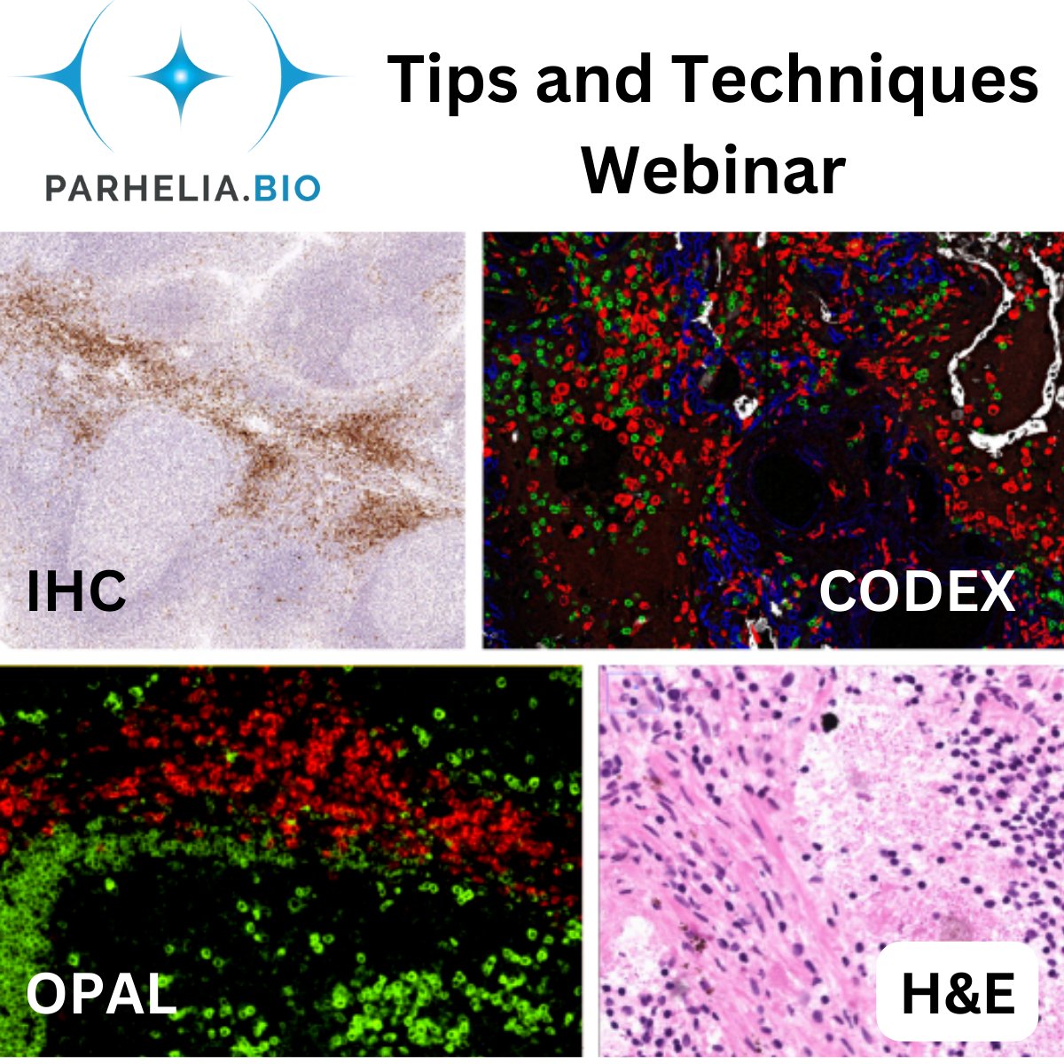 ParheliaBio's tweet photo. Don't forget to register for our practical tissues staining tips and techniques webinar setting up slide and coverslip samples for IHC, CODEX, RNA-FISH, IF and H&amp;E stains on the Parhelia Omni-Stainer™.

December 6th, 12pm EST, 9am PST, 5pm GMT.
https://t.co/JFlFwsmFNX https://t.co/QPt7mUOhnX