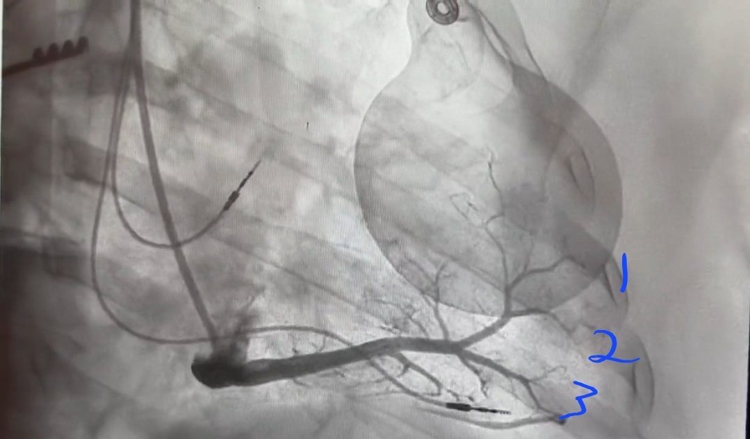 Ian Parker tweet media