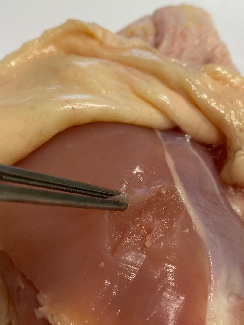 🧵regarding one of the most basic and commonly used instruments in surgery...the DeBakey forceps.

De...