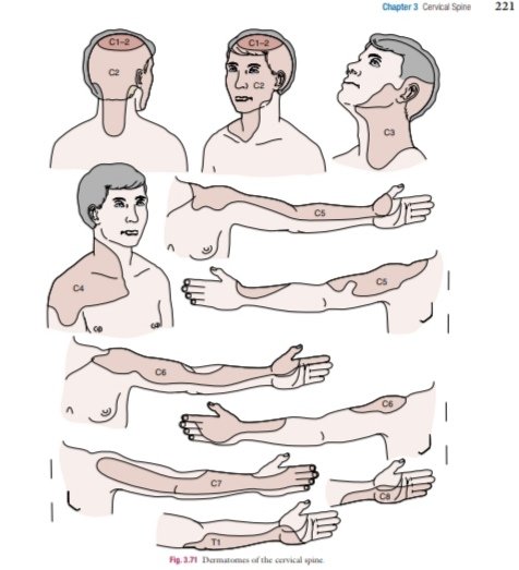 Dermatomes of upper limb ❤️