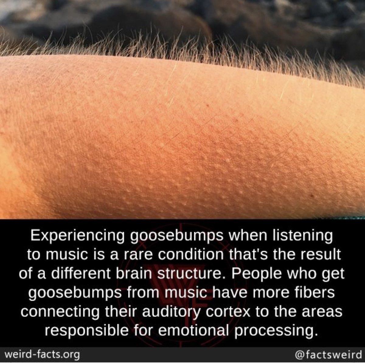 playinglesshurt's tweet image. Did you know? I do get goosebumps. Do you? #music