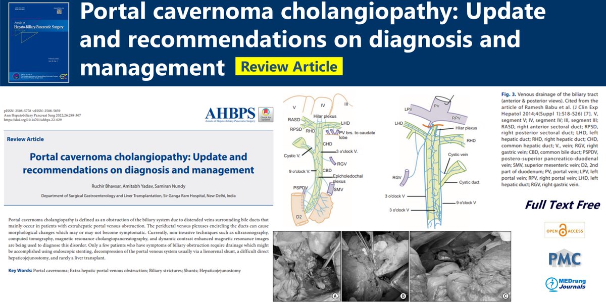 Journal_AHBPS's tweet photo. Portal cavernoma cholangiopathy: Update and recommendations on diagnosis and management
open access🌷https://t.co/YGEBR7ULW8
Ann Hepatobiliary Pancreat Surg 
2022 Nov;26(4)Ruchir Bhavsar
#Extra_hepatic_portal_venous_obstruction #Biliary_strictures #Shunts #Hepaticojejunostomy https://t.co/bs9SqmTXkY