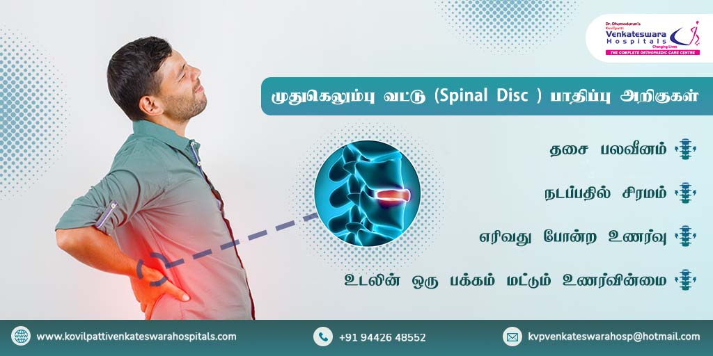 KVHospital's tweet image. முதுகெலும்பு வட்டு  வலி என்பது முன்பெல்லாம் வயதானவர்கள் தான் கூறுவர் ஆனால் இன்று இளம் வயதினரையும் அது தாக்கியுள்ளது.
பிரச்சனை இருப்பின் புறக்கணிக்காதிர்கள்! மருத்துவரை இன்றே அணுகவும்
மேலும் விவரங்களுக்கு தொடர்பு கொள்ளவும் - 9442648552
#spinaldisc #SpinalDisorder #spinehealth