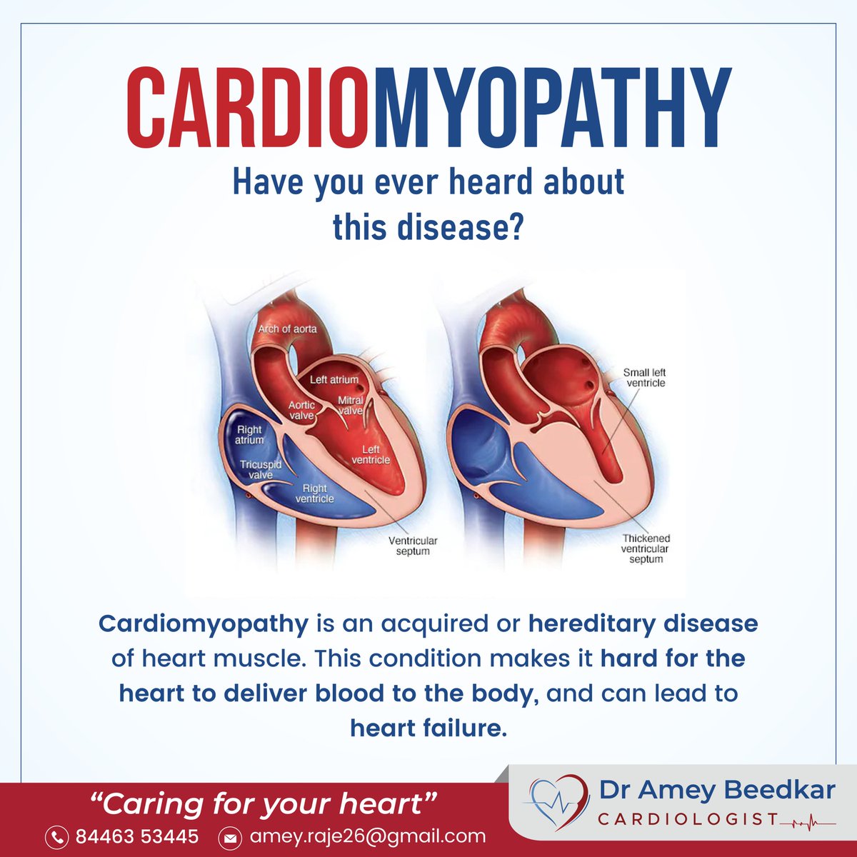 AmeyBeedkar's tweet photo. Don't know what is Cardiomyopathy?
For heart related queries: π+91 8446353445
#hearthealth #heart #heartattack #doctor #cardiologist #heartdiseaseawareness #functionofheart #cardiology #cardiologist #cardiologylife #cardiologyclinic #cardiologyfellow #cardiologydepartment https://t.co/5XAJ63OVGx