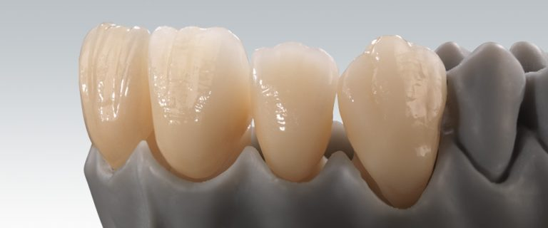 digitdirectdent's tweet photo. ✍️Positive points of Zirconia Crown：
1. The great resemblance to the natural tooth enamel color.
2. In this type of dental crowns metal base is not required.
3. Zirconia resists hot and cold temperatures well.
4. Zirconia resists staining and discoloration.
5.Biocompatible. https://t.co/YDwmZVff6Z
