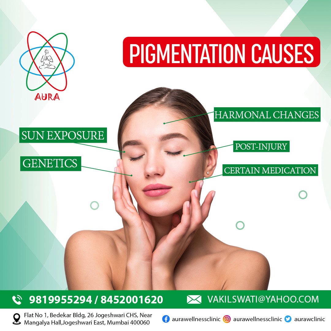 These are some Pigmentation Causes brought to you by Aura Wellness Clinic...
For Booking Information Call us on :9819955294/8452001620
#aurawellnessclinc #Skincare #pigmentation #causes #pigmentationtreatment #skinfairness #skincare #skintreatment #skin #haircare  #mumbai