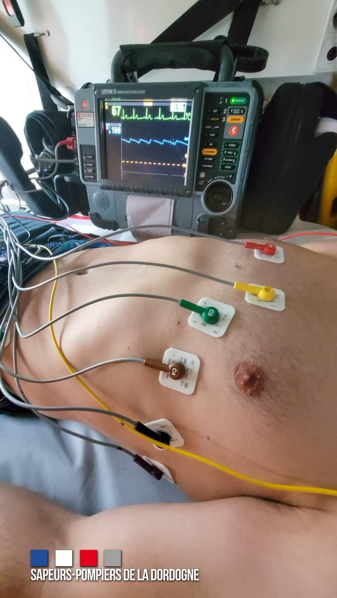 Le service de santé &amp; de secours médical de <a href="/pompiers24/">SDIS 24</a> participe à la prise en charge pré-hospitalière des urgences cardiologiques. En lien avec le SAMU ils télétransmettent les électrocardiogrammes des patients avec des problèmes cardiaques. En 4 ans, 1713 pris en charge 👏