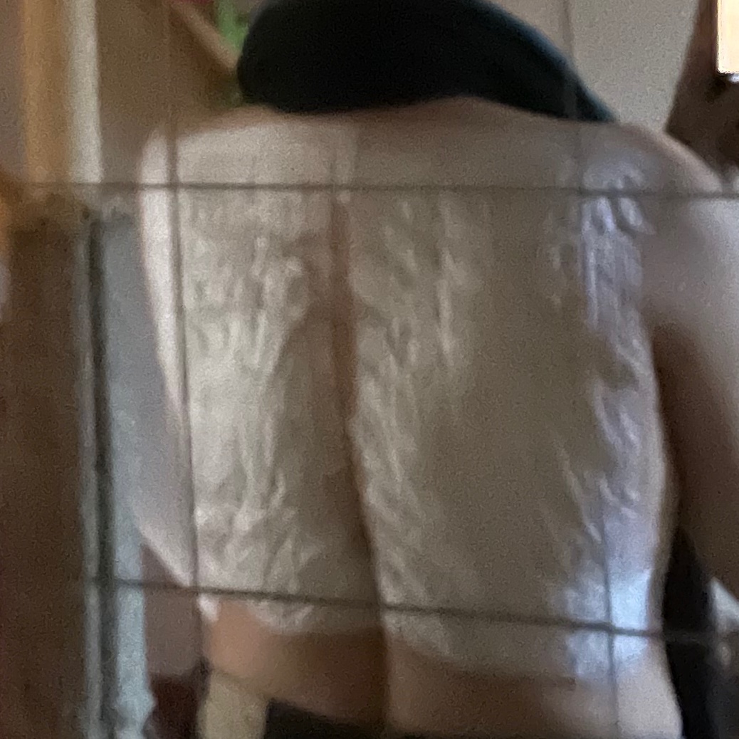 Poebie2404's tweet photo. En toen zaten de plakkers op m'n rug. Ergens tussen de 40 en 50 verschillende dingen dacht ik. Nu, na anderhalf uur, brandt het, prikt en steekt het, trekt het, voelt het warm aan en sommige plekken jeuken. Dat gaat gezellig worden de aankomende 2 dagen. #AllergieTest https://t.co/sKyUlUr606