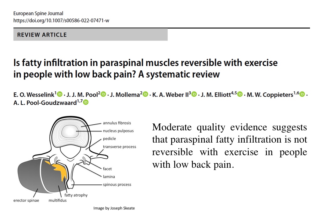 michelcoppie's tweet photo. Congrats @EddoWesselink on your second PhD paper: Open Access (soon) via @EurSpineJournal: https://t.co/GHhXcst7VZ. Cheers 🍻to the collaboration between @VUamsterdam @Stanford @Sydney_Uni &amp; @Griffith_Uni @MenziesHealth https://t.co/DpXCCVUmPm