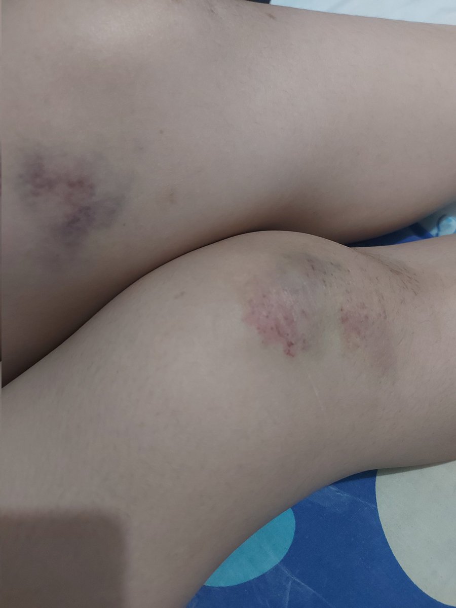 FAULYN (@oolllaaaa) on Twitter photo 