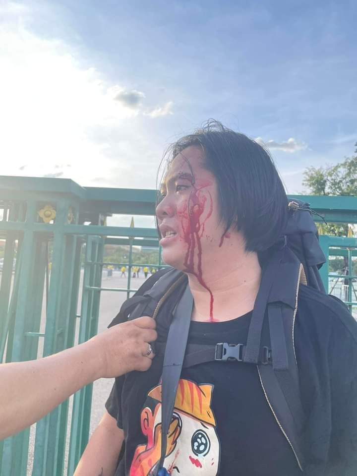 ผมคนนึงที่ไม่นิยมความรุนแรง และหวังว่าคนต่อย คงไม่เปิดบัญชีรับเงินบริจาคนะครับ