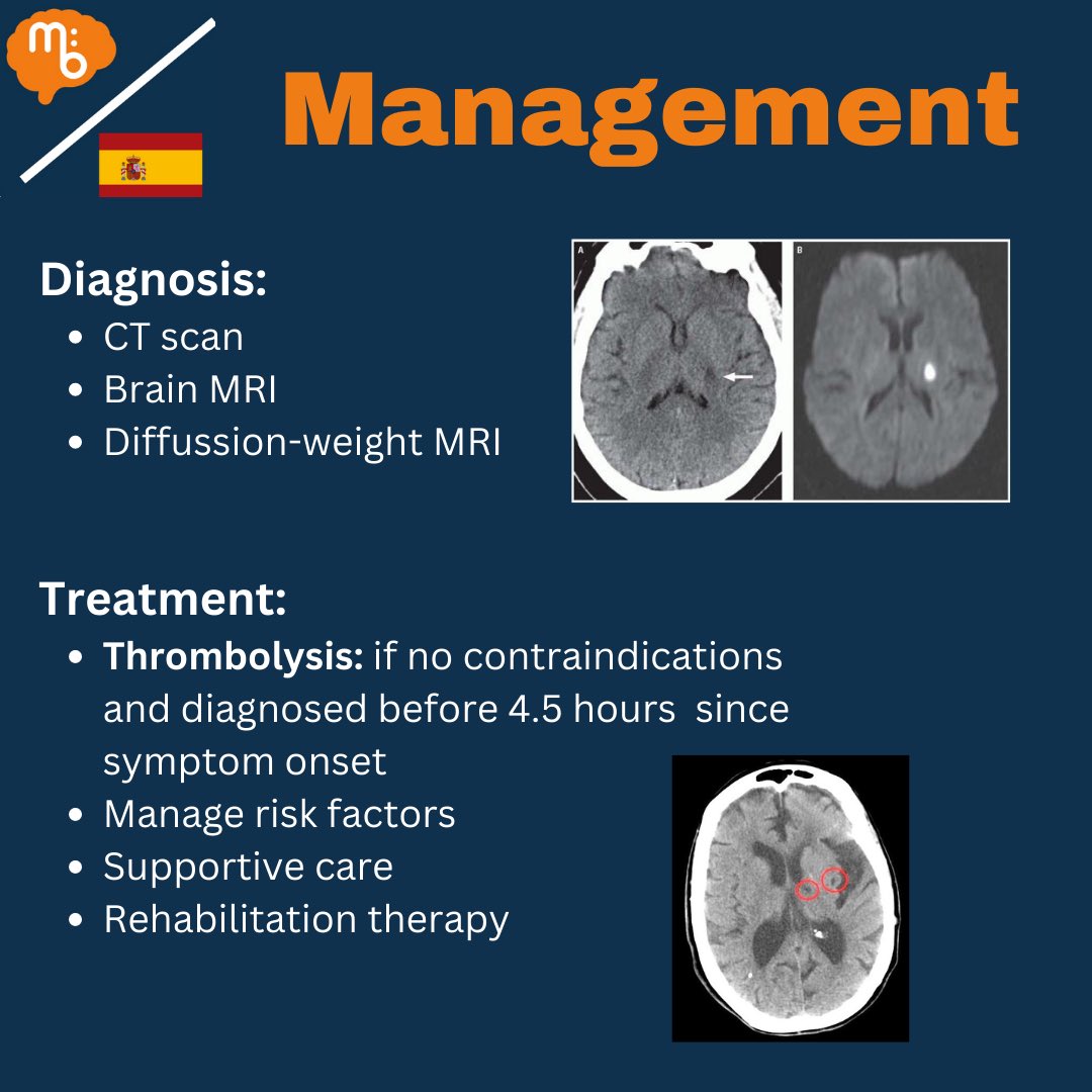Mission:Brain Complutense tweet media
