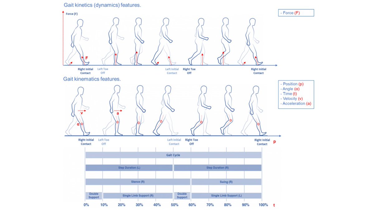 LazzarodiBiase's tweet photo. In the present article, we analyzed gait dynamics and kinematics features in Parkinson's disease vs Healthy subjects, exploring which kind of analysis is more accurate for diagnosis. #neurology #parkinson #movementdisorders #gaitanalysis 

https://t.co/J2vVHlUJ6w https://t.co/mDeSbKdLFL