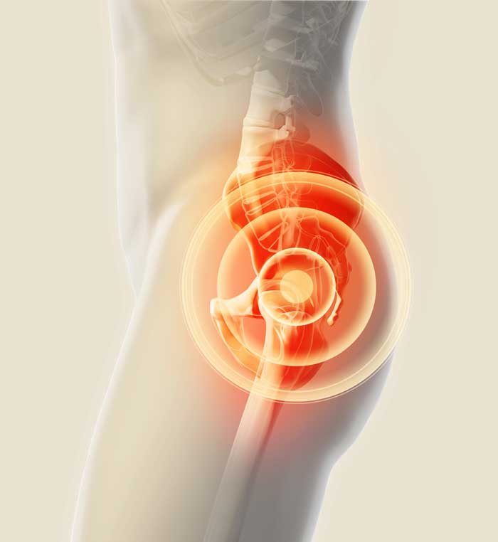 nashvilleorthos's tweet photo. The source of pain with this #ischiofemoral #impingement is not always clear. A skilled #ultrasonographer can inject this area, which helps to confirm the diagnosis and can have therapeutic value in reducing symptoms. Alternatively...https://t.co/AeqYRgC9Zb #hipinjection https://t.co/gCzKYFOqys